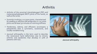 Arthritis
▪ Arthritis of the proximal interphalangeal (PIP) and
metacarpophalangeal (MCP) joints of the hands, as
well as the wrists
▪ Synovitis involving 2 or more joints, characterized
by swelling or effusion OR tenderness in 2 or more
joints and at least 30 minutes of morning stiffness
▪ Tenderness, edema, and effusions accompany a
polyarthritis that is symmetric, nonerosive, and
usually nondeforming
▪ Jaccoud arthropathy is the term used to describe
the nonerosive hand deformities due to chronic
arthritis and tendonitis that develop in 10% of
patients with SLE. Jaccoud arthropathy
 