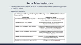 Renal Manifestations
▪ Urine protein–to-creatinine ratio (or 24-hour urine protein) representing 500 mg
protein/24 hours
▪ Red blood cell casts
 