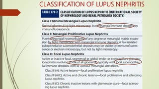 CLASSIFICATION OF LUPUS NEPHRITIS
 
