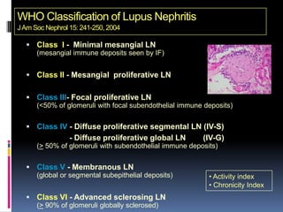WHO Classification of Lupus Nephritis
J Am Soc Nephrol 15: 241-250, 2004

   Class I - Minimal mesangial LN
      (mesangial immune deposits seen by IF)


   Class II - Mesangial proliferative LN


   Class III- Focal proliferative LN
      (<50% of glomeruli with focal subendothelial immune deposits)


   Class IV - Diffuse proliferative segmental LN (IV-S)
                 - Diffuse proliferative global LN       (IV-G)
      (> 50% of glomeruli with subendothelial immune deposits)


   Class V - Membranous LN
      (global or segmental subepithelial deposits)         • Activity index
                                                           • Chronicity Index
   Class VI - Advanced sclerosing LN
      (> 90% of glomeruli globally sclerosed)
 