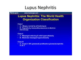 Lupus Nephritis
 