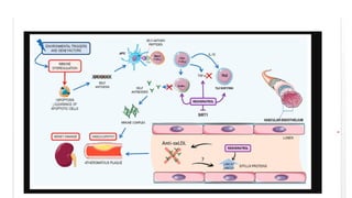 Comprehensive Overview of Systemic Lupus Erythematosus: Pathophysiology ...
