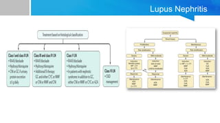 Lupus Nephritis
 