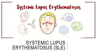 SYSTEMIC LUPUS
ERYTHEMATOSUS (SLE)
 