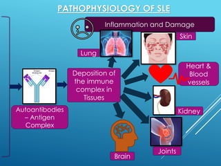 Systemic Lupus Erythematosus (SLE) | PDF