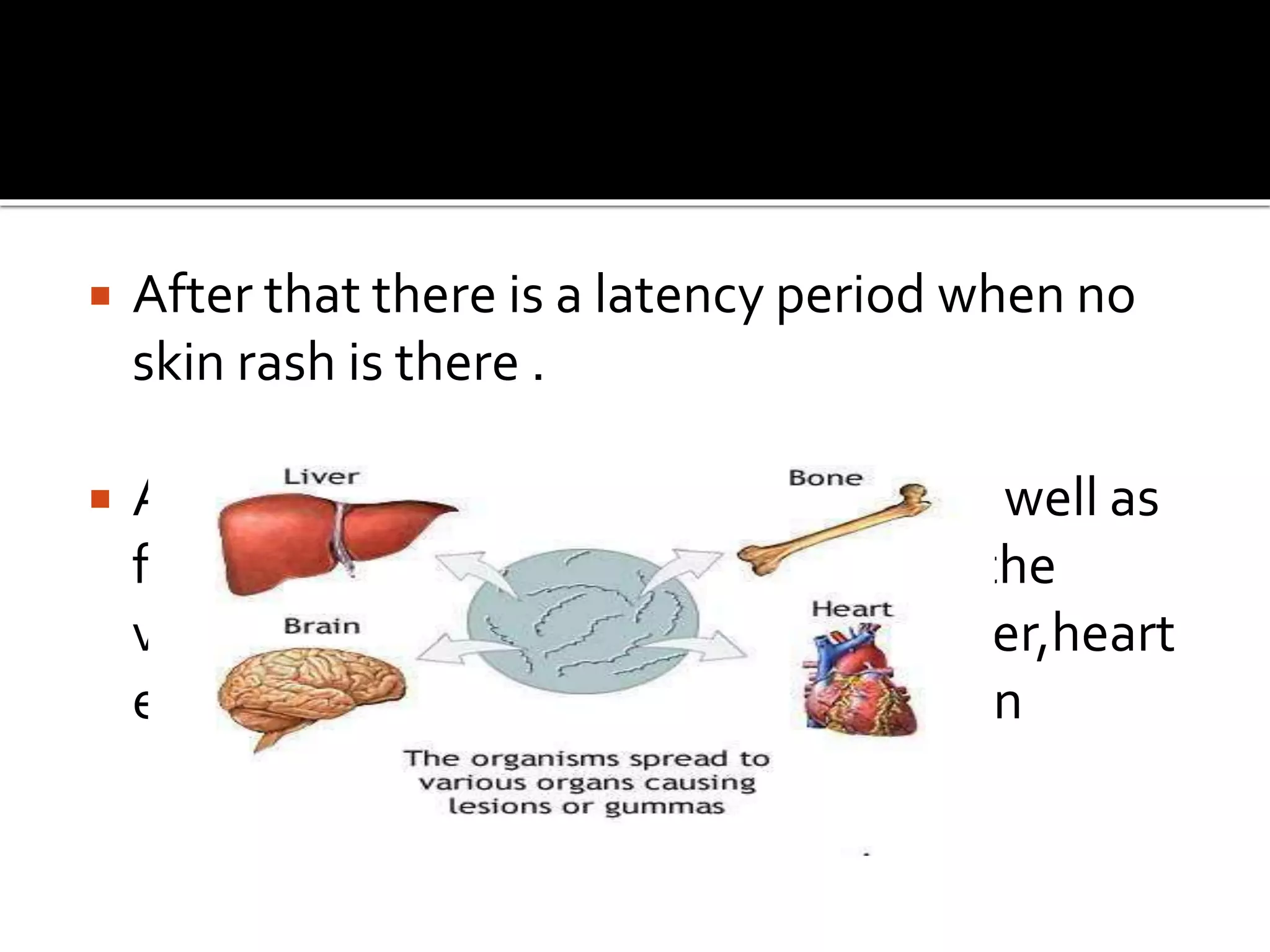  After that there is a latency period when no
skin rash is there .
 At this stage this AgAb complexes as well as
few slow growing treponema enters the
various organs such as brain ,eyes ,liver,heart
etc to produce systemic manifestation
 