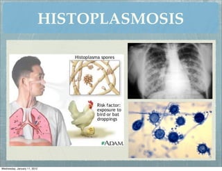 HISTOPLASMOSIS




Wednesday, January 11, 2012
 