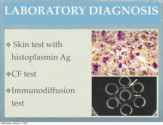 LABORATORY DIAGNOSIS

            Skin test with
          histoplasmin Ag

          CF test

          Immunodiffusion
          test

Wednesday, January 11, 2012
 