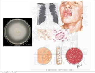 Wednesday, January 11, 2012
 