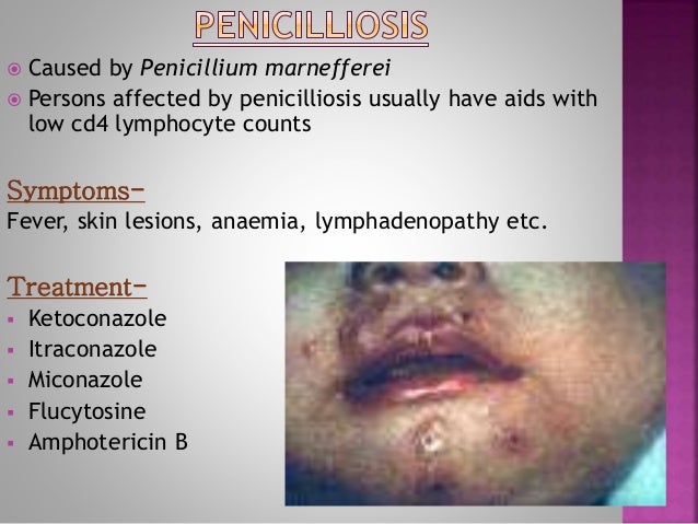infection yeast treatment skin Systemic Mycoses