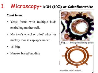 1. Microscopy- KOH (10%) or Calcofluorwhite
Yeast form:
• Yeast forms with multiple buds
encircling mother cell.
• Mariner’s wheel or pilot’ wheel or
mickey mouse cap appearance
• 15-30µ
• Narrow based budding
 