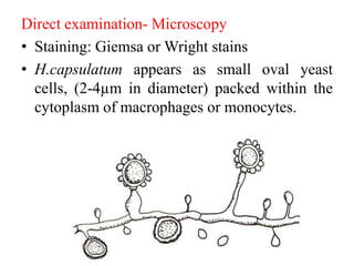 Direct examination- Microscopy
• Staining: Giemsa or Wright stains
• H.capsulatum appears as small oval yeast
cells, (2-4µm in diameter) packed within the
cytoplasm of macrophages or monocytes.
 