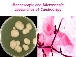 Macroscopic and Microscopic
appearance of Candida spp
 