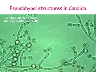 Pseudohypal structures in Candida
 
