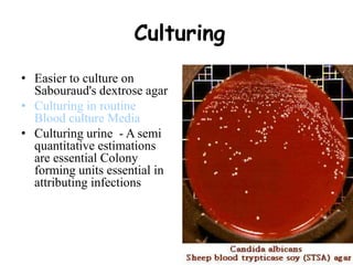 Culturing
• Easier to culture on
Sabouraud's dextrose agar
• Culturing in routine
Blood culture Media
• Culturing urine - A semi
quantitative estimations
are essential Colony
forming units essential in
attributing infections
 