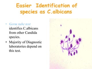 Easier Identification of
species as C.albicans
• Germ tube test
identifies C.albicans
from other Candida
species.
• Majority of Diagnostic
laboratories depend on
this test.
 