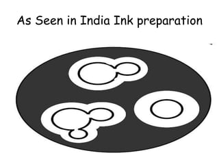 As Seen in India Ink preparation
 
