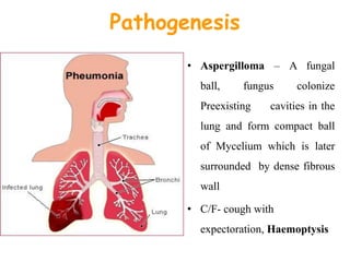 Pathogenesis
• Aspergilloma – A fungal
ball, fungus colonize
Preexisting cavities in the
lung and form compact ball
of Mycelium which is later
surrounded by dense fibrous
wall
• C/F- cough with
expectoration, Haemoptysis
 