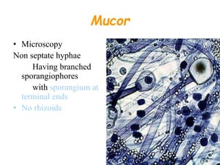 Mucor
• Microscopy
Non septate hyphae
Having branched
sporangiophores
with sporangium at
terminal ends
• No rhizoids
 