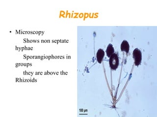 Rhizopus
• Microscopy
Shows non septate
hyphae
Sporangiophores in
groups
they are above the
Rhizoids
 