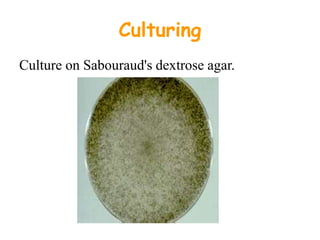 Culturing
Culture on Sabouraud's dextrose agar.
 