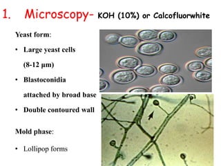 1. Microscopy- KOH (10%) or Calcofluorwhite
Yeast form:
• Large yeast cells
(8-12 μm)
• Blastoconidia
attached by broad base
• Double contoured wall
Mold phase:
• Lollipop forms
 