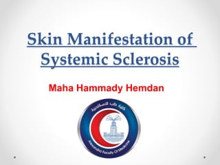 Skin Manifestation of
Systemic Sclerosis
Maha Hammady Hemdan
 