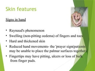 Skin features
Signs in hand
• Raynaud's phenomenon
• Swelling (non-pitting oedema) of fingers and toes
• Hard and thickened skin
• Reduced hand movements- the 'prayer sign(patients
may be unable to place the palmar surfaces together)
• Fingertips may have pitting, ulcers or loss of bulk
from finger pads.
 