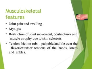 Musculoskeletal
features
• Joint pain and swelling
• Myalgia
• Restriction of joint movement, contractures and
muscle atrophy due to skin sclerosis
• Tendon friction rubs - palpable/audible over the
flexor/extensor tendons of the hands, knees
and ankles.
 