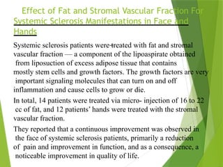 Effect of Fat and Stromal Vascular Fraction For
Systemic Sclerosis Manifestations in Face and
Hands
Systemic sclerosis patients were treated with fat and stromal
vascular fraction — a component of the lipoaspirate obtained
from liposuction of excess adipose tissue that contains
mostly stem cells and growth factors. The growth factors are very
important signaling molecules that can turn on and off
inflammation and cause cells to grow or die.
In total, 14 patients were treated via micro- injection of 16 to 22
cc of fat, and 12 patients’ hands were treated with the stromal
vascular fraction.
They reported that a continuous improvement was observed in
the face of systemic sclerosis patients, primarily a reduction
of pain and improvement in function, and as a consequence, a
noticeable improvement in quality of life.
 