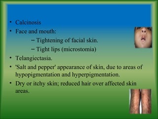 • Calcinosis
• Face and mouth:
– Tightening of facial skin.
– Tight lips (microstomia)
• Telangiectasia.
• 'Salt and pepper' appearance of skin, due to areas of
hypopigmentation and hyperpigmentation.
• Dry or itchy skin; reduced hair over affected skin
areas.
 