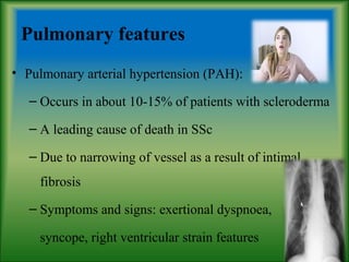 Pulmonary features
• Pulmonary arterial hypertension (PAH):
– Occurs in about 10-15% of patients with scleroderma
– A leading cause of death in SSc
– Due to narrowing of vessel as a result of intimal
fibrosis
– Symptoms and signs: exertional dyspnoea,
syncope, right ventricular strain features
 