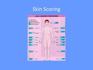 Systemic sclerosis | PPT