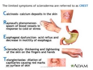 10/23/2017 Dr Doha Rasheedy
 