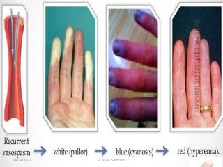 10/23/2017 Dr Doha Rasheedy
 