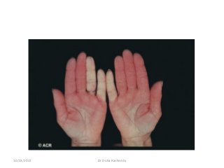 10/23/2017 Dr Doha Rasheedy
 