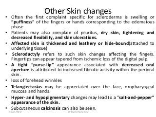 Other Skin changes
• Often the first complaint specific for scleroderma is swelling or
“puffiness” of the fingers or hands corresponding to the edematous
phase.
• Patients may also complain of pruritus, dry skin, tightening and
decreased flexibility, and skin ulcerations.
• Affected skin is thickened and leathery or hide-bound(attached to
underlying tissue)
• Sclerodactyly refers to such skin changes affecting the fingers.
Fingertips can appear tapered from ischemic loss of the digital pulp.
• A tight “purse-lip” appearance associated with decreased oral
aperture is attributed to increased fibrotic activity within the perioral
skin.
• loss of forehead wrinkles
• Telangiectasias may be appreciated over the face, oropharyngeal
mucosa and hands.
• Hyper- and hypopigmentary changes may lead to a “salt-and-pepper”
appearance of the skin.
• Subcutaneous calcinosis can also be seen.
10/23/2017 Dr Doha Rasheedy
 