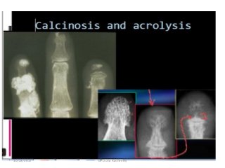 10/23/2017 Dr Doha Rasheedy
 