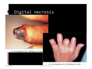 10/23/2017 Dr Doha Rasheedy
 