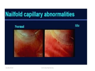 10/23/2017 Dr Doha Rasheedy
 