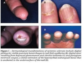 10/23/2017 Dr Doha Rasheedy
 