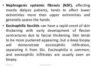 • Nephrogenic systemic fibrosis (NSF), affecting
mostly dialysis patients, tends to affect lower
extremities more than upper extremities and
generally spares the hands.
• Eosinophilic fasciitis can have a rapid onset of skin
thickening with early development of flexion
contractures due to fascial thickening. Skin tends
to be more puckered appearing, but a deep biopsy
will demonstrate eosinophilic infiltration,
separating it from SSc. Eosinophilia is common,
and eosinophilic infiltrates are usually seen on
biopsy.
10/23/2017 Dr Doha Rasheedy
 