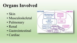 • Skin
• Musculoskeletal
• Pulmonary
• Renal
• Gastrointestinal
• Cardiac
Organs Involved
 