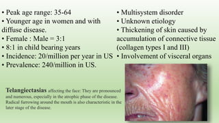 Telangiectasias affecting the face: They are pronounced
and numerous, especially in the atrophic phase of the disease.
Radical furrowing around the mouth is also characteristic in the
later stage of the disease.
• Multisystem disorder
• Unknown etiology
• Thickening of skin caused by
accumulation of connective tissue
(collagen types I and III)
• Involvement of visceral organs
• Peak age range: 35-64
• Younger age in women and with
diffuse disease.
• Female : Male = 3:1
• 8:1 in child bearing years
• Incidence: 20/million per year in US
• Prevalence: 240/million in US.
 