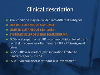 Incidence is 9-19 cases/million/year.
