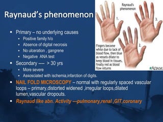Concordance among twins is low.,but ANA is high..