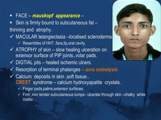 PathologyFollowing pathogenic mechanisms always present:Endothelial cell injuryFibroblast activationCellular and humoral  immunologic derangement.Activation of the immune system is an outstanding disease feature. –autoantibodies,perivascular lymphocytes (cd4 T )Chronic forms of GVHD shares features of SSc. 