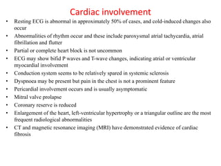 Cardiac involvement
• Resting ECG is abnormal in approximately 50% of cases, and cold-induced changes also
occur
• Abnormalities of rhythm occur and these include paroxysmal atrial tachycardia, atrial
fibrillation and flutter
• Partial or complete heart block is not uncommon
• ECG may show bifid P waves and T-wave changes, indicating atrial or ventricular
myocardial involvement
• Conduction system seems to be relatively spared in systemic sclerosis
• Dyspnoea may be present but pain in the chest is not a prominent feature
• Pericardial involvement occurs and is usually asymptomatic
• Mitral valve prolapse
• Coronary reserve is reduced
• Enlargement of the heart, left-ventricular hypertrophy or a triangular outline are the most
frequent radiological abnormalities
• CT and magnetic resonance imaging (MRI) have demonstrated evidence of cardiac
fibrosis
 