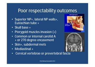 Poor respectability outcomes
• Superior NP+, lateral NP walls+,
Eustachian tube +
• Skull base +
• Pterygoid muscles invas...