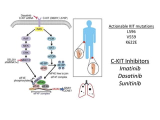 C-KIT Inhibitors
Imatinib
Dasatinib
Sunitinib
Actionable KIT mutations
L596
V559
K622E
 
